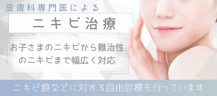 ニキビ治療